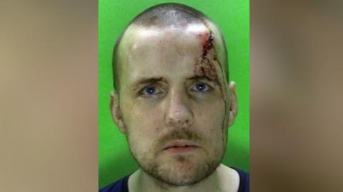 Shamus Doyle pictured in a mugshot with an injury on his head