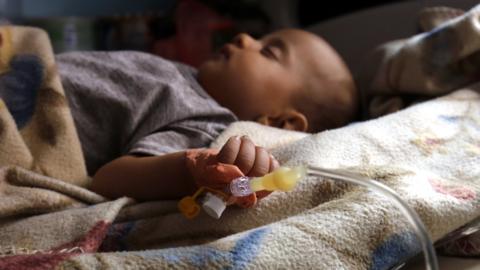 A cholera-infected Yemeni child receives treatment at a hospital in Sanaa, Yemen (6 July 2017)