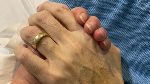 A close up of two hands clasping each other with a gold ring on one finger