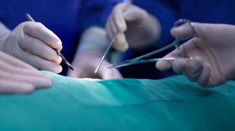 Photo of hands of operating room staff performing surgery. The instruments being held include a scalpel and forceps. There is a green medical sheet covering the patient.
