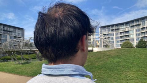 The back of a young man's head. He is looking out to a park. 