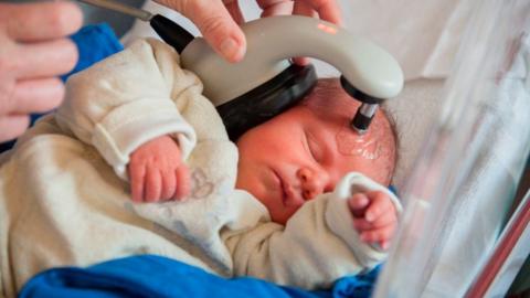 ABR testing on a newborn baby