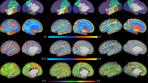 3D reconstruction of the brain's surface from newborn brain MRI data