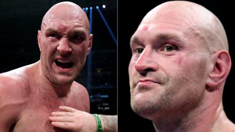 Tyson Fury