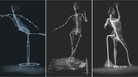 Degas x rays