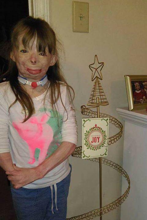 Arson survivor Safyre Terry has been sent hundreds of Christmas cards to fill her tree.
