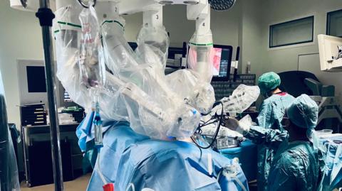 Surgeons in an operating theatre at Southmead hospital carry out a procedure using robotic arms. The image shows a patient covered in blue surgical sheets. Two medical staff stand beside the patient and robotic arms covered in plastic sheeting are above the patient. 