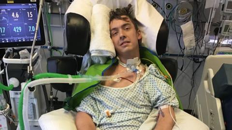 A man lies in a hospital bed hooked up to several machines. He looks at the camera as his head rests against a white folded up towel. Several tubes are attached around his neck and a monitor can be seen on the left.