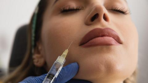 A close-up of a woman's face as she lies back, waiting for a filler injection in her upper lip, as a needle hovers above her mouth