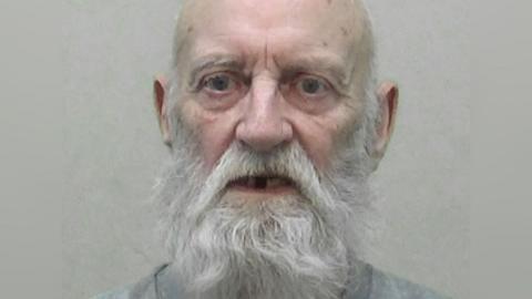Stanley Burnett, a man in his mid-70s. He has a bald head and a long, white beard. His mouth is agape and some of his teeth are missing. His expression appears to be one of concern.