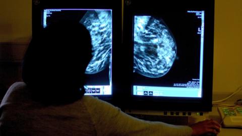 A woman sitting in front of two computer screens showing scans of breasts. The woman has her back to the camera. The images show the inside of the breasts in bright blue. 