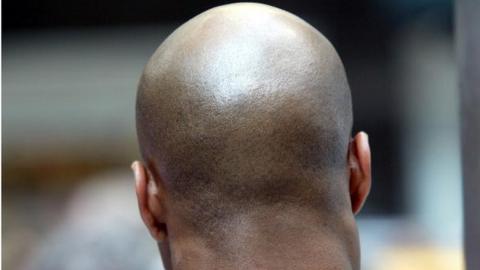 Black bald man