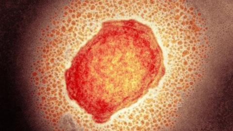 Monkeypox virus particle
