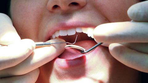 A dentist inspects a patient's mouth.