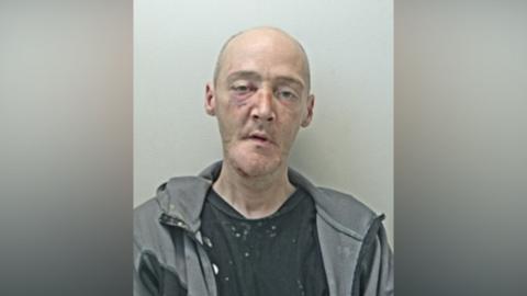 Peter Vernal, a man wearing a grey jacket over a black top with white marks on it, stares vacantly forward in a mugshot.