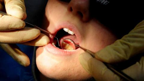 A close up of a dentist's hands, covered in surgical gloves, carrying out an examination in someone's mouth. 