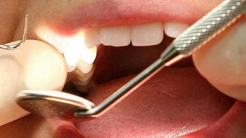 A patient's mouth being examined by a dentist who is wearing white gloves.