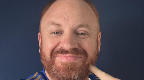 Image shows Eli's face. He is pointing at his beard which is fairly thick so far and is ginger.