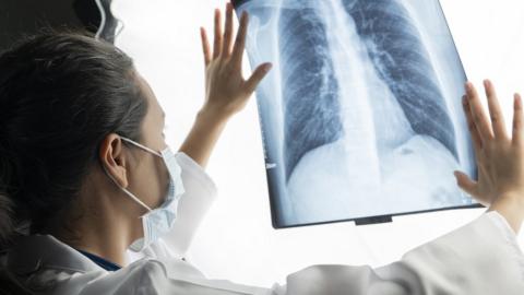 radiologist looks at lung x-rays