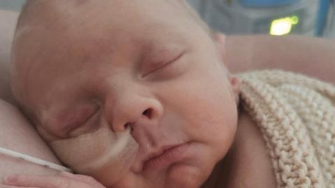 Close up of baby Anthony's face. He has a tube going into his left nostril and looks to be asleep. The white tube has been taped down to his cheek. He has been wrapped in a beige knitted blanket. 