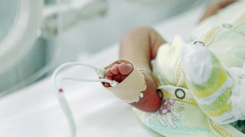 A premature baby in hospital with a tube connected to their foot