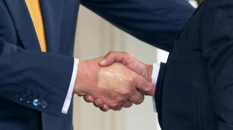 A close up of Trump shaking someone's hand. The back of his hand bears an obvious patch of makeup that does not match his skin tone