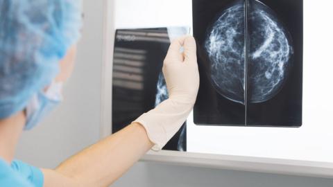 Woman looking at x-ray