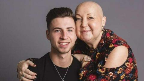 A man stood next to his mother, who is wearing a floral top and has her arms around him. His mother, a cancer patient, has no hair.