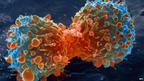 Lung cancer cells