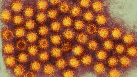 Norovirus