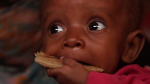 Toddler in Yemen internally displaced persons camp