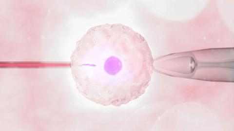 Illustration of in vitro fertilisation (IVF) where the sperm is inserted into the egg in a test tube, to create an embryo which is then implanted into a woman to create a pregnancy