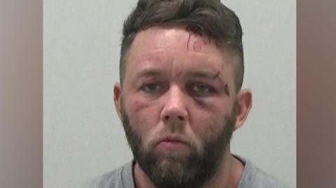 A mugshot of Ross Neville. He has brown hair and a beard. He has cuts across his left eyebrow and on his forehead.