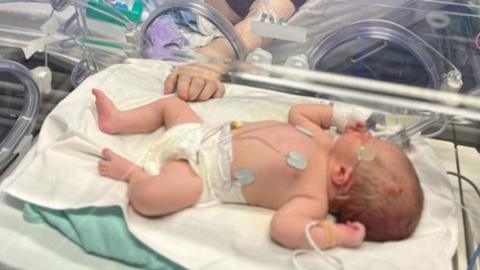 Newborn baby Roddy in an incubator at the neonatal unit. He is lying on his side asleep. He has a tube up his nose and wires attached to his chest. There are also wires attached to his skull.