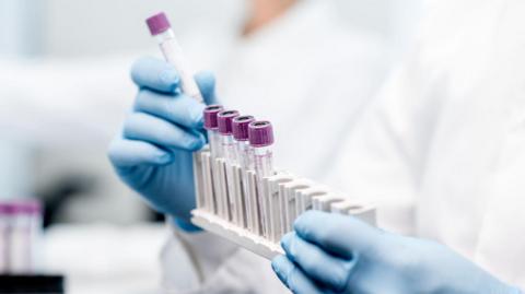 A person in a white lab coat and blue surgical gloves holding a rack of test tubes with purple lids.