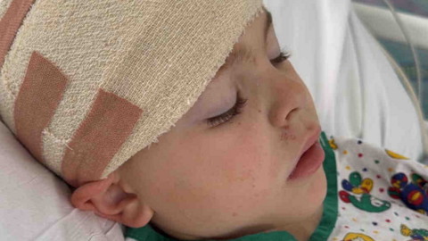 A close-up of a boy with a medical bandage around his head. His eyes are closed and he is wearing a gown.