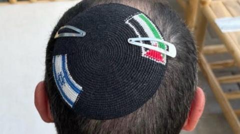 Top view of a man's head with a kippah embroidered with an Israel flag and a Palestinian flag
