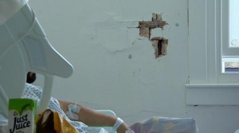 Man in hospital bed, only his arm is visible. There is a hole in the wall behind him, through which plaster and lath is clearly visible