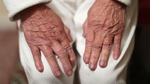 An elderly woman's hands resting on her knees as she stands up