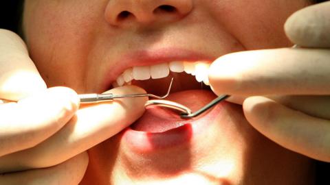 A person is having a dental check up.  A surgeon is wearing gloves, holding two implements, while the patient has their mouth open.