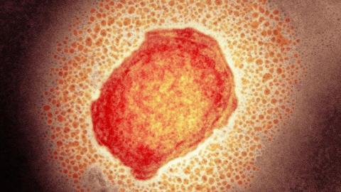 Monkeypox virus particle