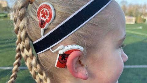 A side view of Milly wearing her newly branded hearing aid with the colours of AFC Portchester. She is on the pitch and her hair is braided.