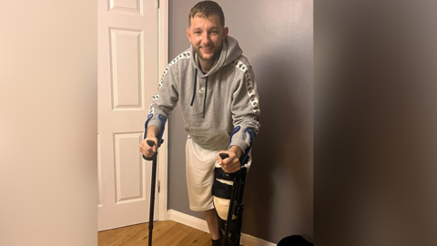 Joel Collins, who was attacked after a football game, smiles as he stands in a home on two crutches with a cast on his leg. 