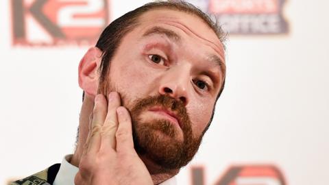 Tyson Fury