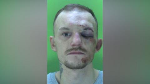 A police mugshot of James Rylance - he is a man with a black eye, short hair and stubble.