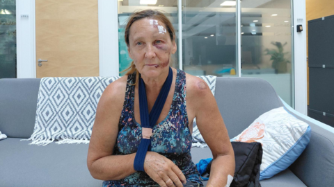 A woman sitting on a grey sofa wearing a blue tank top, with her right arm in a navy blue sling. She has bruising on her face and stitches on her head.