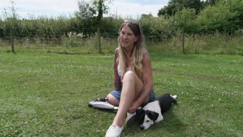 Caroline sits on some grass in a field with her small, black and white dog. Her prosthetic leg is visible as she is wearing shorts. It is metal.