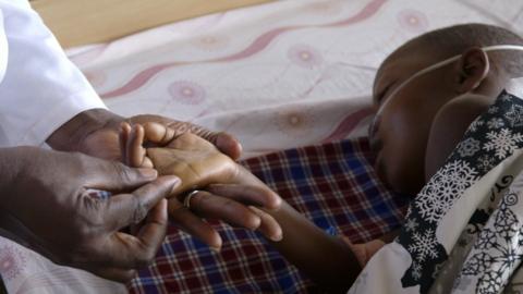 A hospital doctor treats a young girl with malaria