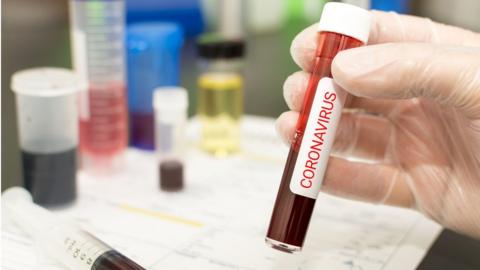 Coronavirus test