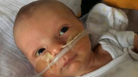 A newborn in a baby grow with medical tubes up his nose and across his face.